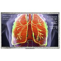 Màn hình TFT & phụ kiện